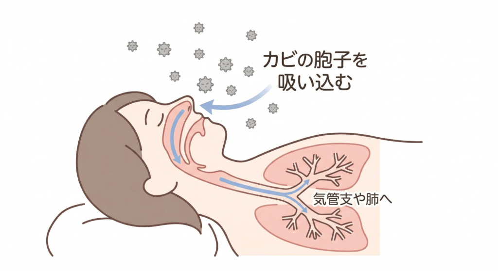 カビの部屋で寝るとどうなる？放置で起こる健康被害と危険なサイン